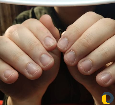 Наращивания ногтей