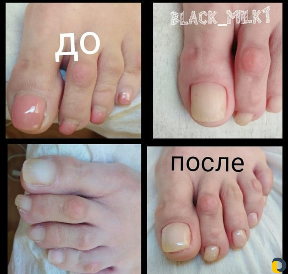 Ногтевой сервис