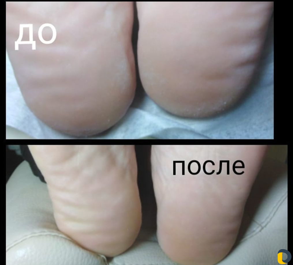 Ногтевой сервис