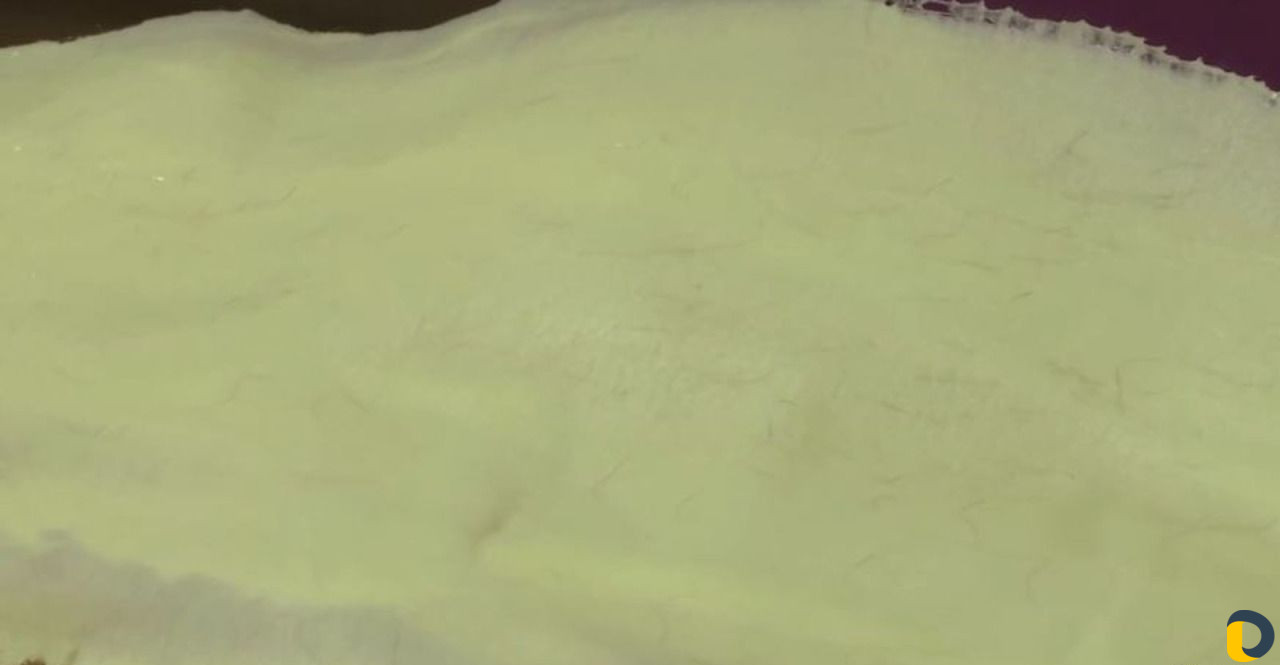 Новым способом Депиляция от 2 мм