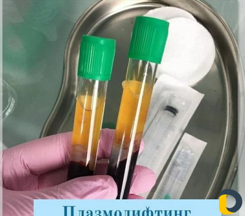 Нужны модели для косметолога