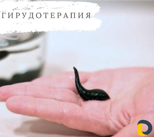 Обучение гирудотерапии