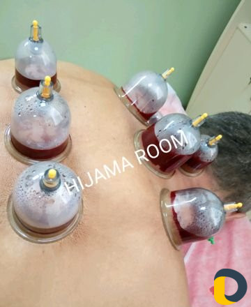 Обучение хиджаме, массажу