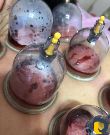 Обучение хиджаме