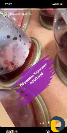 Обучение хиджаме