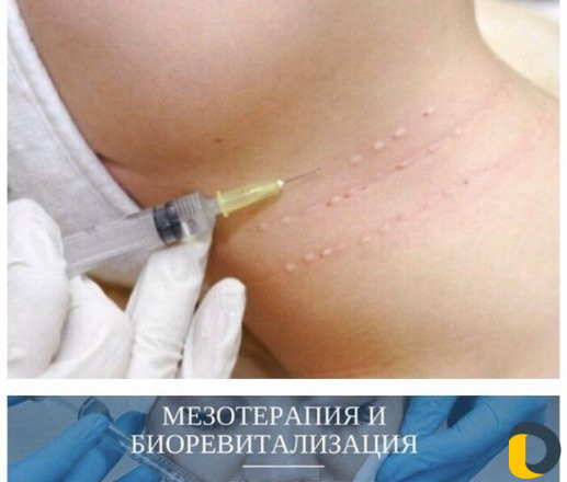Обучение косметологии и микроблейдингу