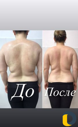 Обучение курсы массажиста