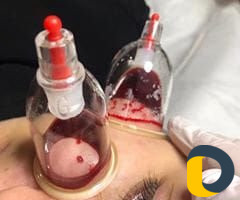 Обучение + подарок узаппарат каждой ученице