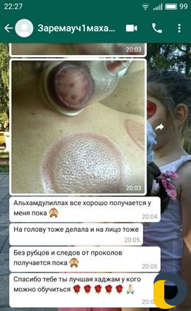 Обучение + подарок узаппарат каждой ученице