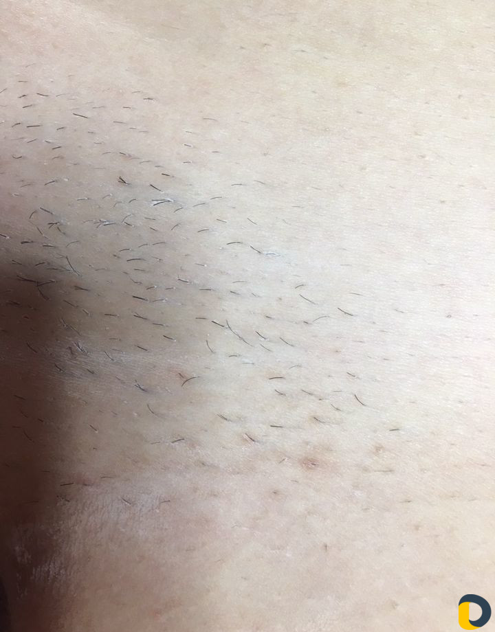 Обучение/Шугаринг/Воск