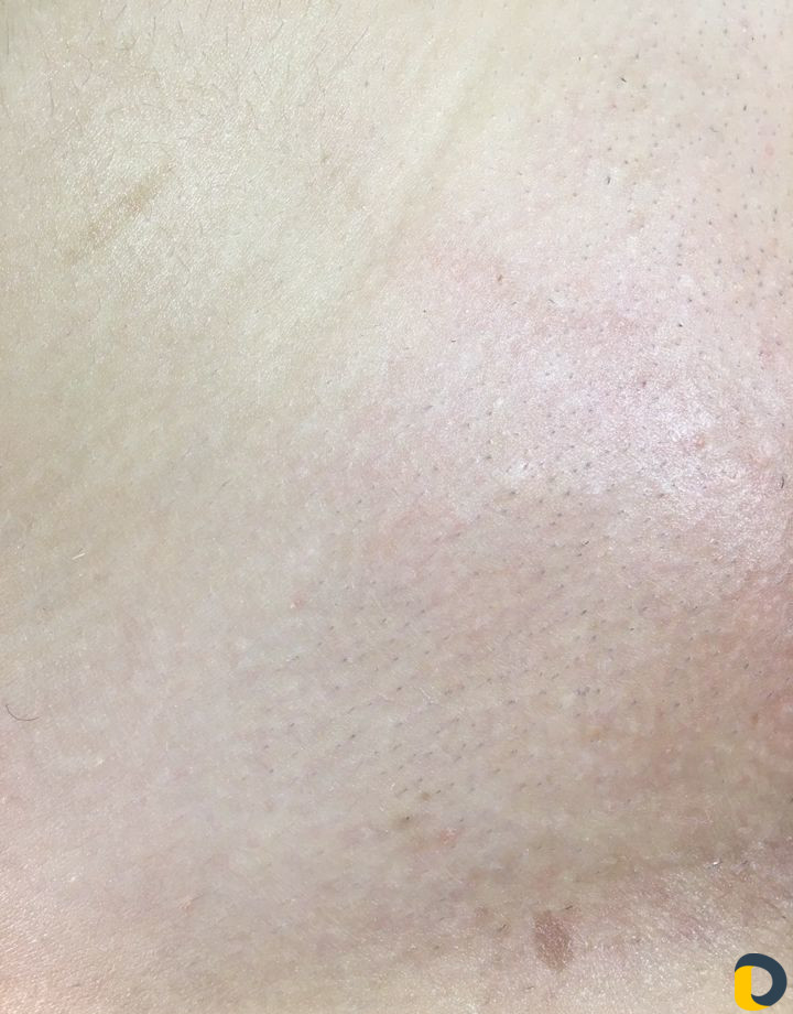 Обучение/Шугаринг/Воск