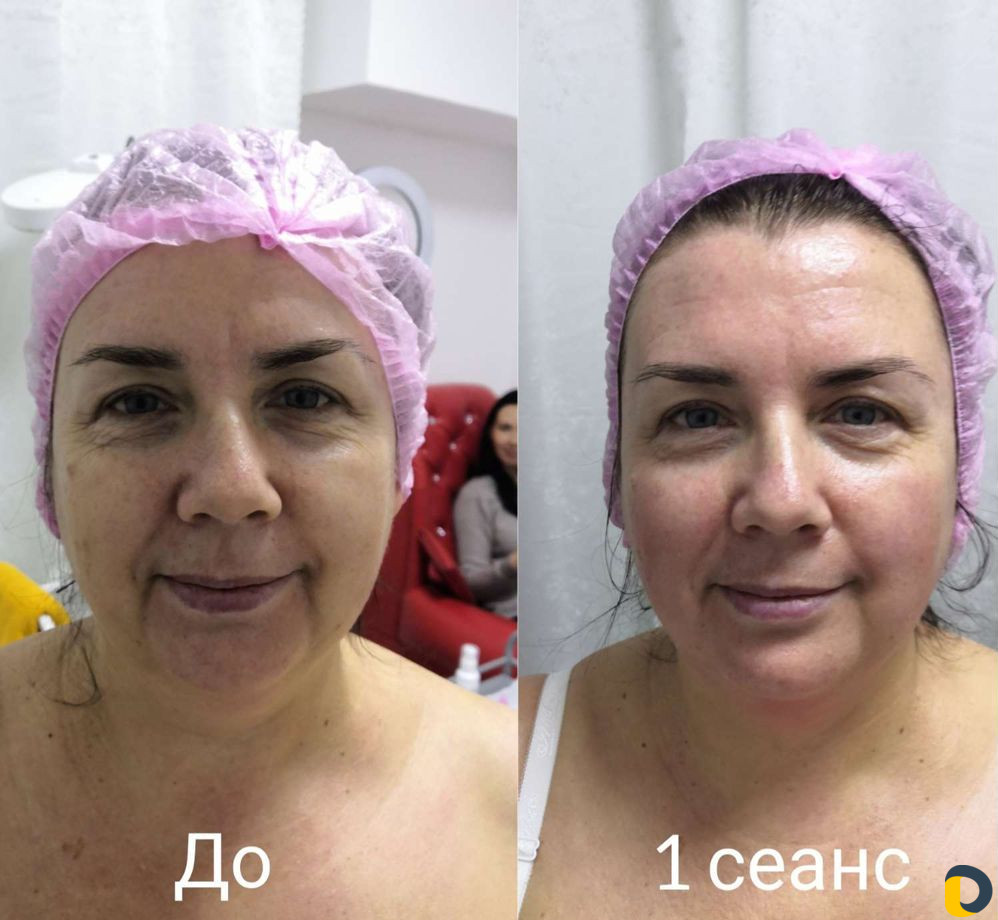 Омолаживающий массаж лица