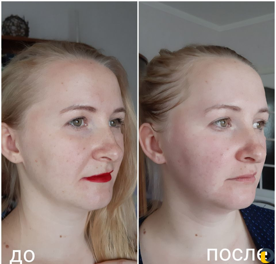 Омолаживающий массаж лица