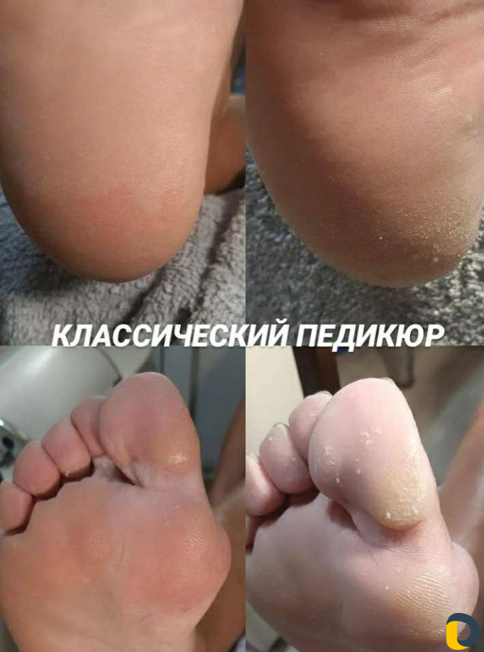 Педикюр