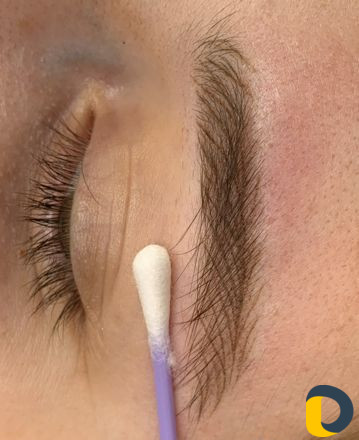 Перманентный макияж и удаление татуажа