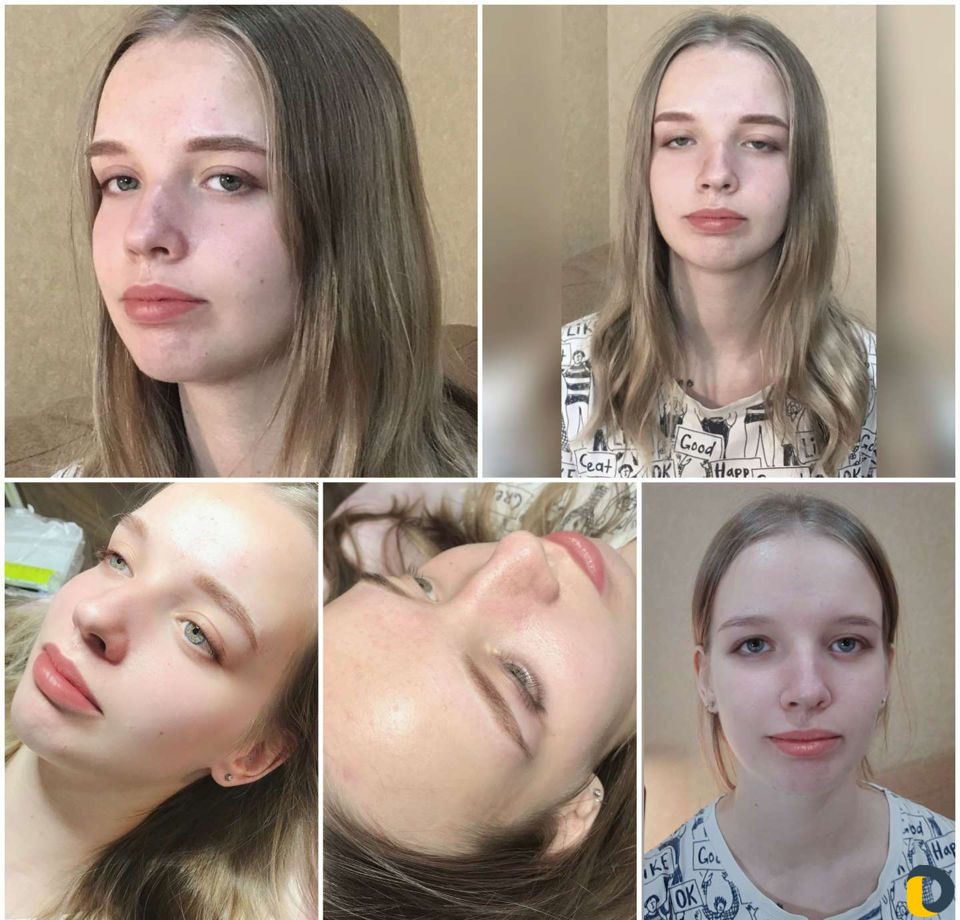 Перманентный макияж, удаление