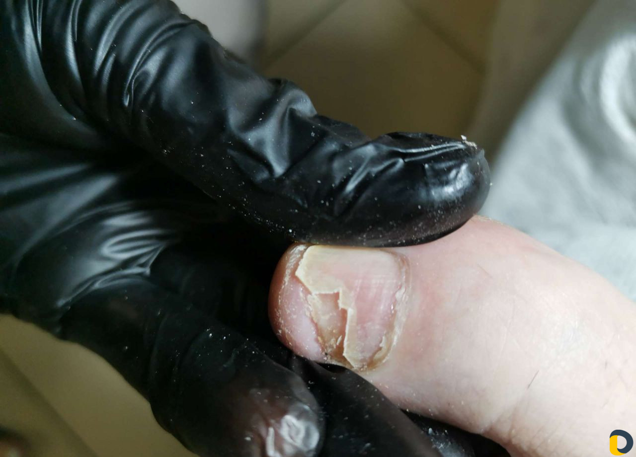 Подология