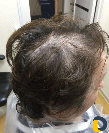 Прикорневой объём волос