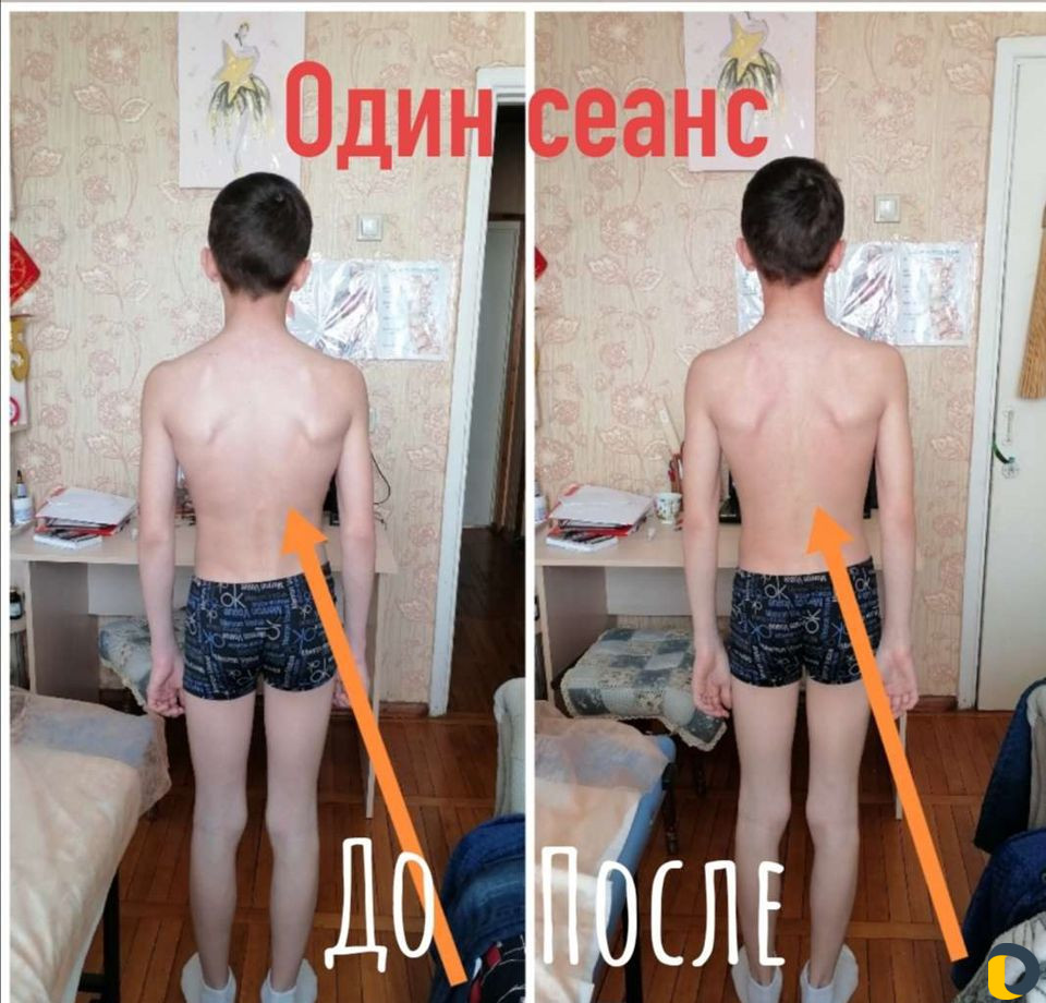 Профилактика и оздоровления организма