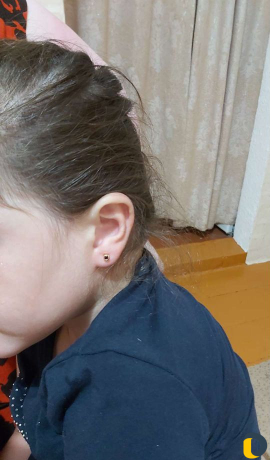 Прокалывание ушей