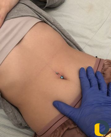 Прокол ушей, пирсинг пупка, пирсинг