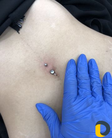 Прокол ушей, пирсинг пупка, пирсинг
