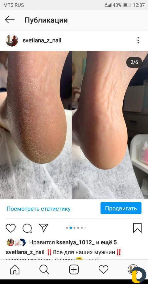 Прокол ушей