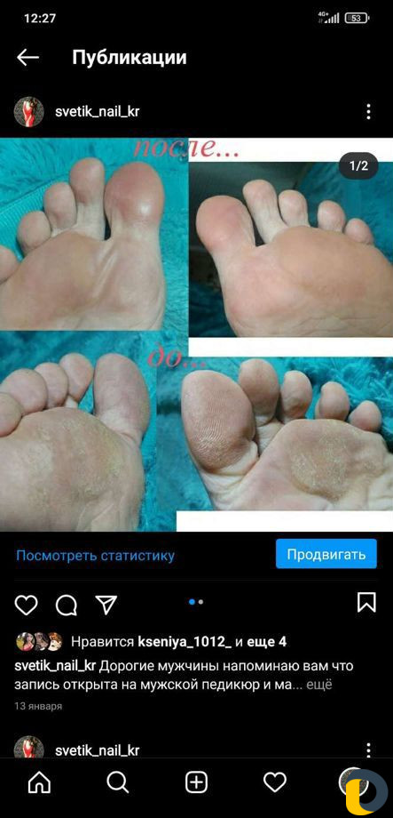 Прокол ушей