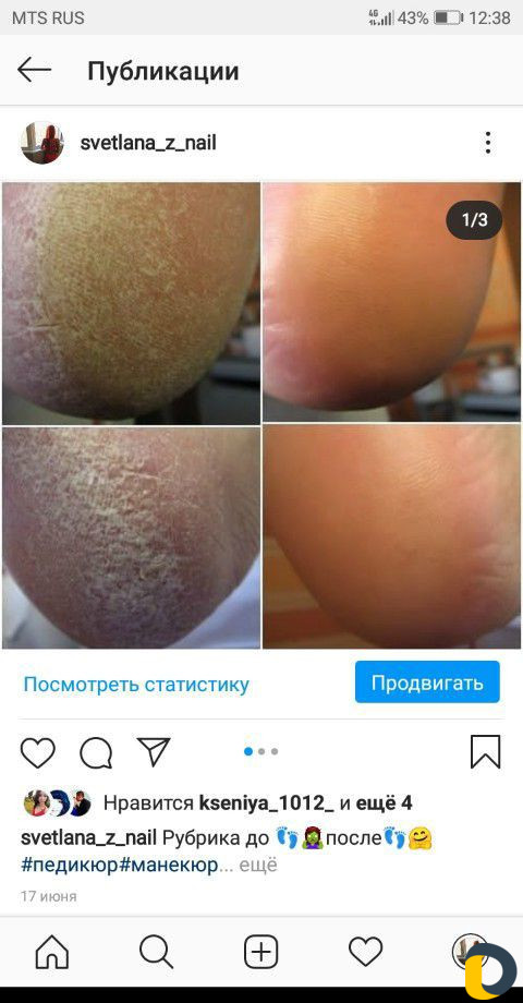 Прокол ушей