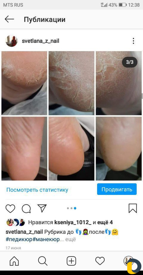 Прокол ушей