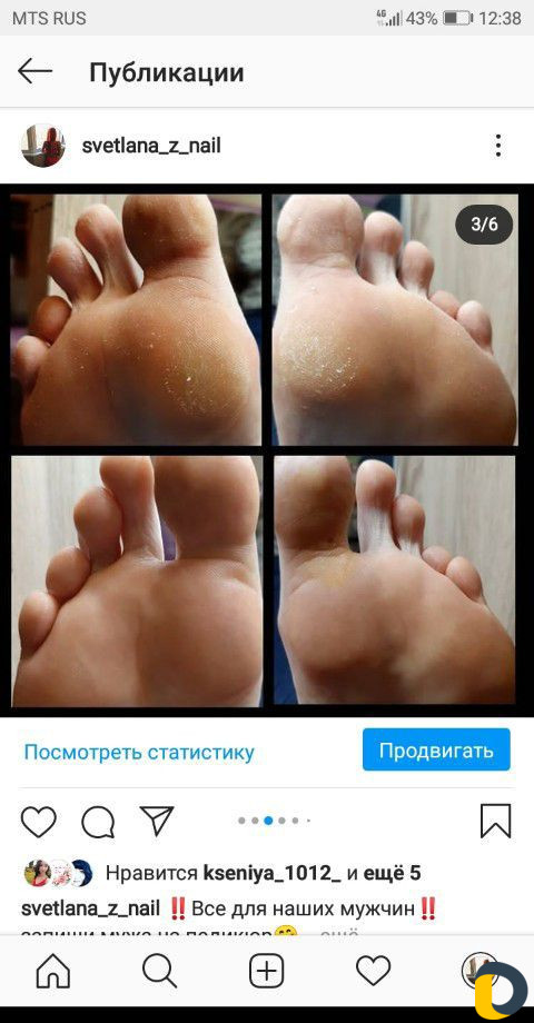 Прокол ушей