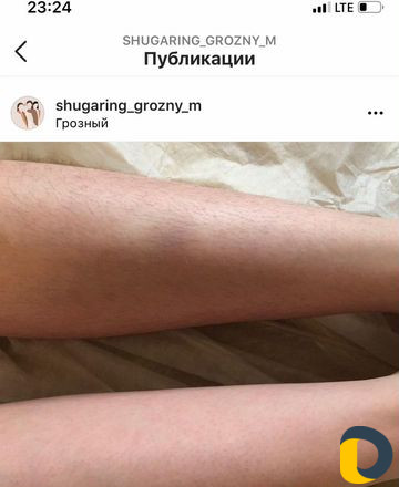 Шугаринг
