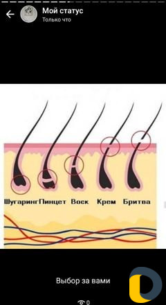 Шугаринг