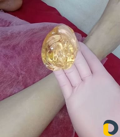 Шугаринг