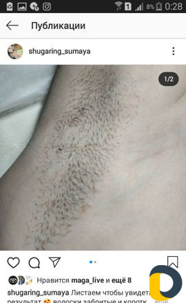 Шугаринг