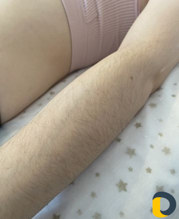Шугаринг