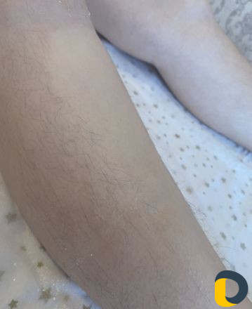 Шугаринг