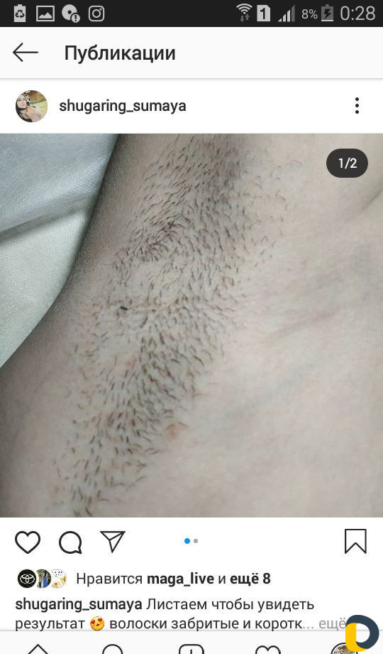 Шугаринг