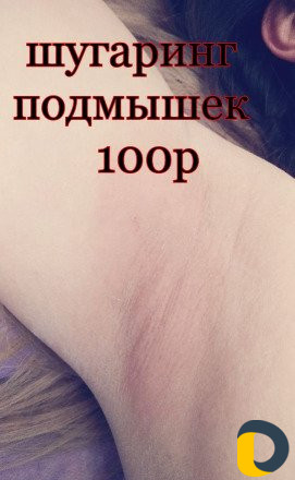 Шугаринг