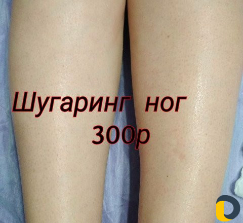 Шугаринг