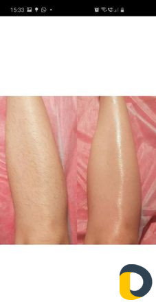 Шугаринг воосковая эпиляция плёночный воск