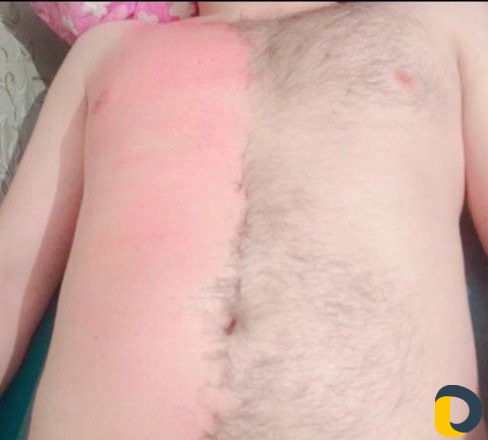 Шугаринг воск