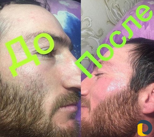 Шугаринг воск