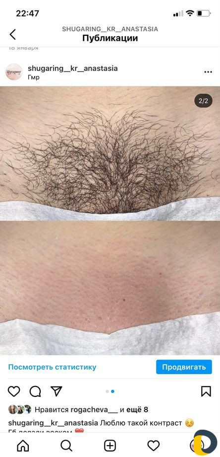 Шугаринг / восковая депиляция / воск