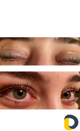 Шугаринг, восковая эпиляция, пленочный воск