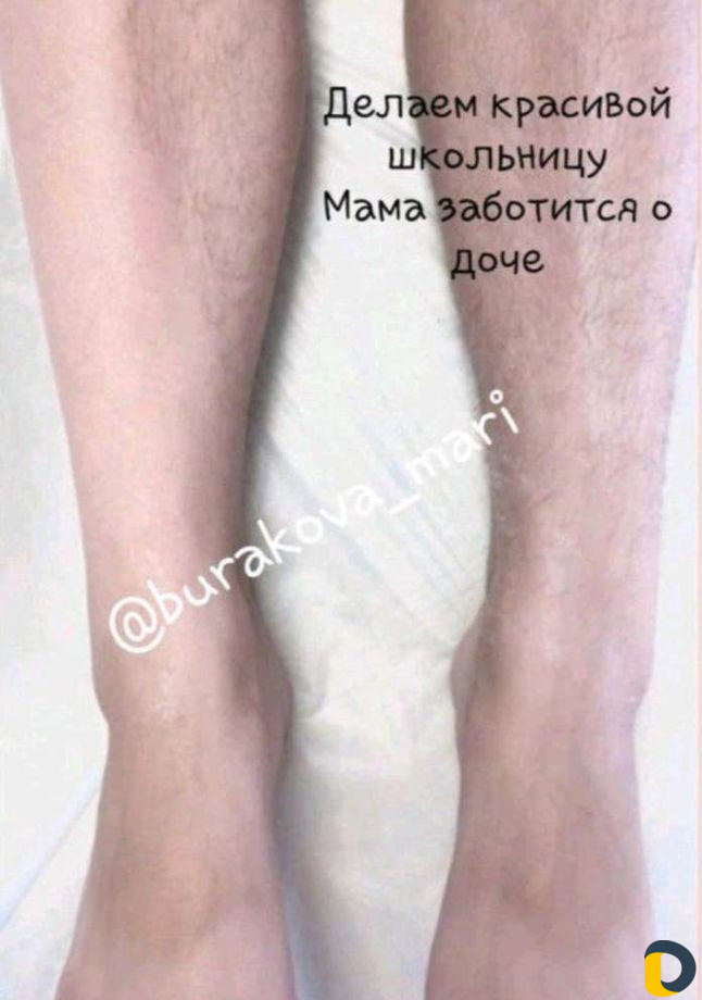 Шугаринг. Женская и мужская депиляция