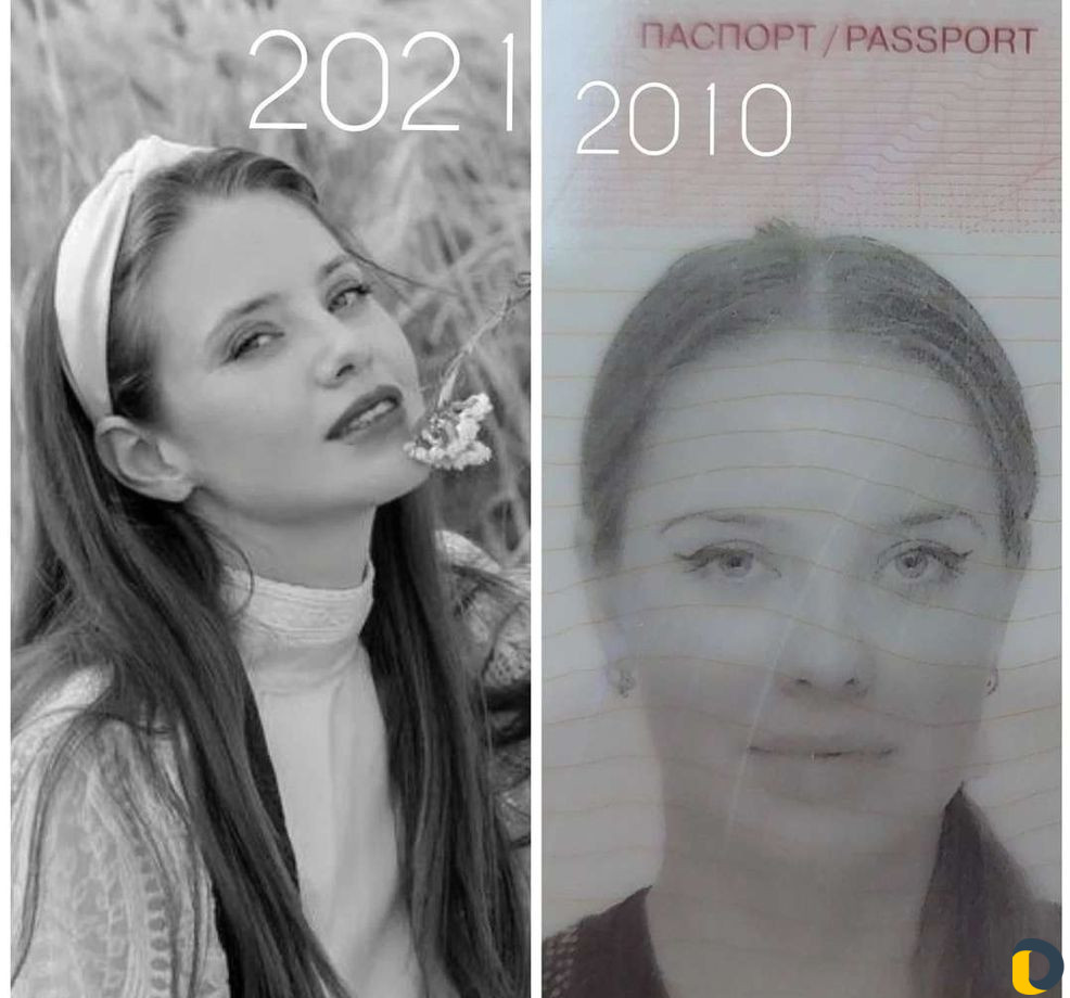 Скульптурный лифтинг лица