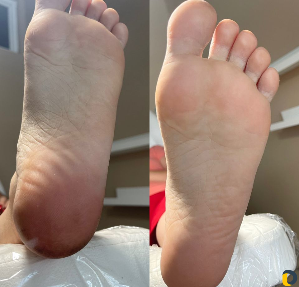 Смарт педикюр