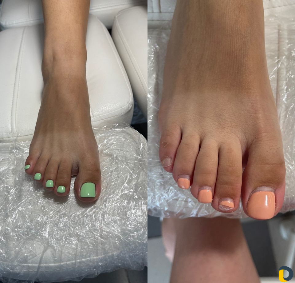 Смарт педикюр