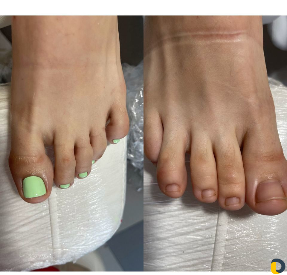 Смарт педикюр